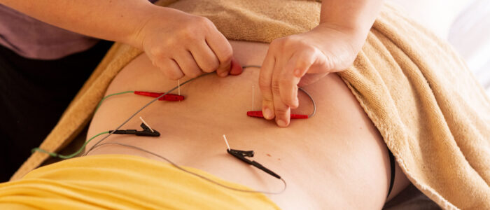 Apoyando con electro acupuntura tratamientos para el dolor agudo y crónico.